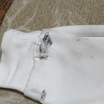 Adidas Ürününün Kalitesizliği Ve Garanti Sorunu!