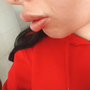 Kosmetolog_lalita Güzellik Merkezi Mağduriyeti Ve Güven Sorunu