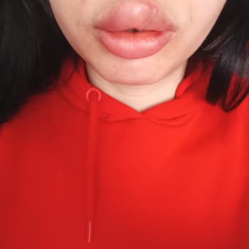 Kosmetolog_lalita Güzellik Merkezi Mağduriyeti Ve Güven Sorunu