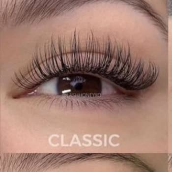 Göz Yanması Ve Kalitesiz Hizmet Deneyimi