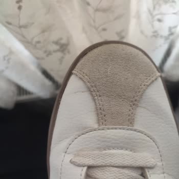 Adidas Ayakkabıda Erken Aşınma Ve Mağaza İlgisizliği