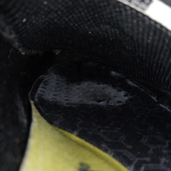 Skechers Ayakkabıda Erken Deformasyon Ve Yetersiz Müşteri Hizmeti