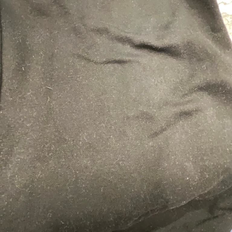 Renk Solması Şikayeti Ve Yetersiz Destek