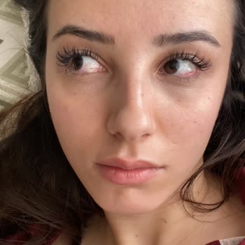 Hijyen Eksikliği Ve İlgisizlik Nedeniyle Kirpik Sorunu