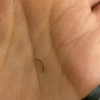 Hijyen Eksikliği Ve İlgisizlik Nedeniyle Kirpik Sorunu