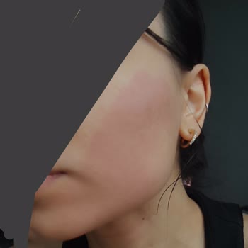 Güvendiğim Markanın Ürünü Yüzümü Tahriş Etti