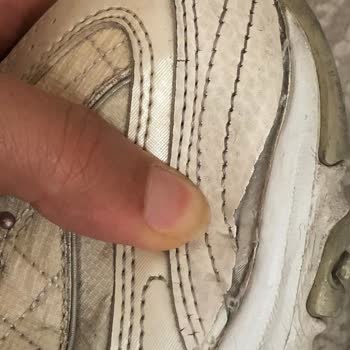 Skechers Ayakkabılarında Kalite Hayal Kırıklığı