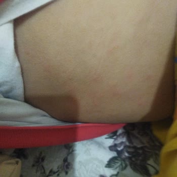 Yüksek Fiyatlı Nemlendirici Cilt Sorunlarına Yol Açtı