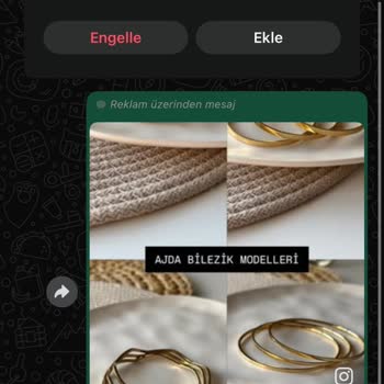 Paslanmaz Çelik Bileziklerin Hızla Soyulması