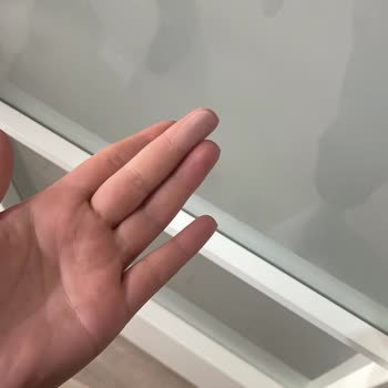 Yetersiz Temizlik Ve Müşteri Memnuniyetsizliği