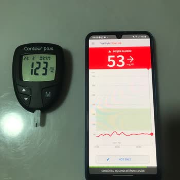 Libre 2 Sensör Yanlış Ölçüm Sorunu