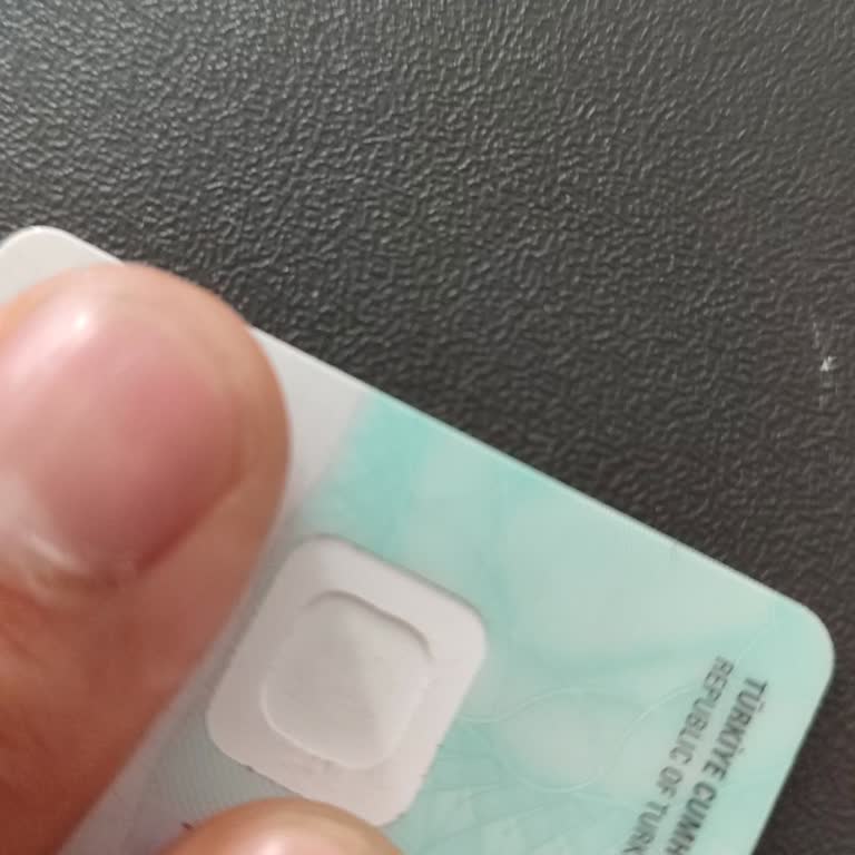 Nüfus Ve Vatandaşlık İşleri T.C. Kimlik Kartı Çipi Düştü!
