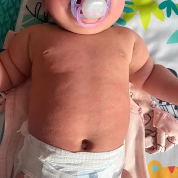 Ecowell Bebek Losyonu Cilt Alerjisine Sebep Oldu!