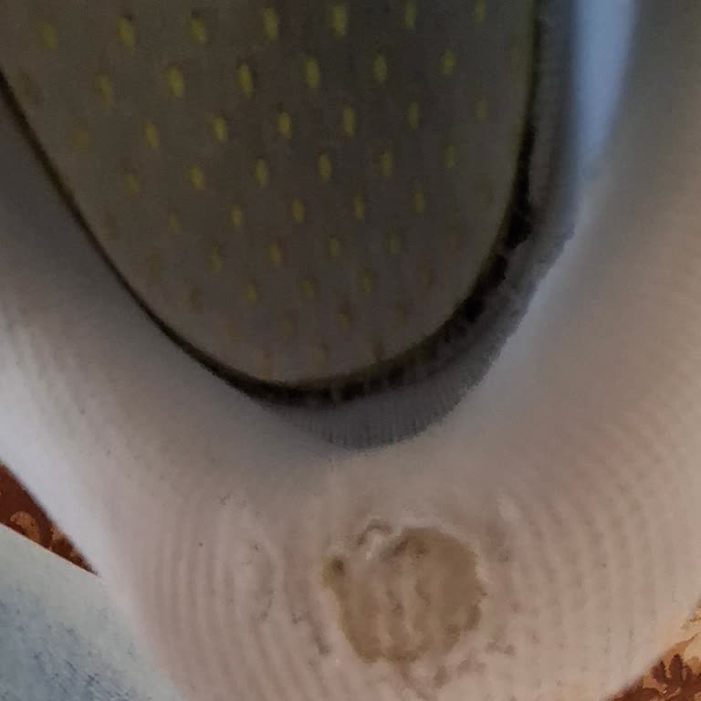 Adidas Ayakkabının Dayanıklılığı Hayal Kırıklığı Yarattı!