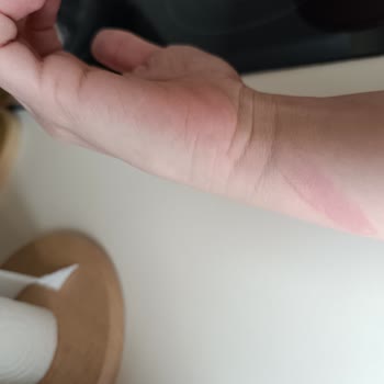 Tehlikeli Balonlar: Hem Cüzdana Hem Sağlığa Zarar