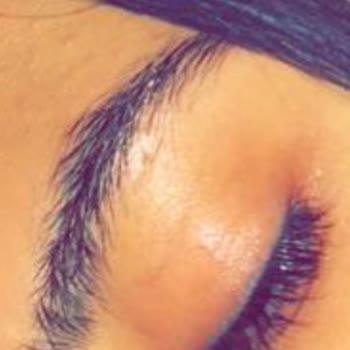 Kaş Doldurma Felaketi: Cevapsız Kalan Şikayetler