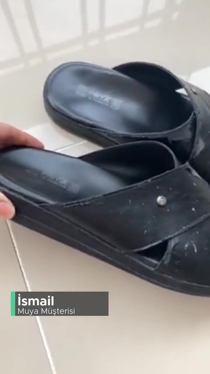 Muya Erkek Terliği Derisinde Soyulmalar Meydana Geldi! videonun kapak resmi