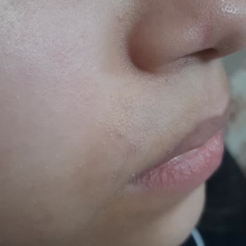 Cerave Crema Irritó la Piel de Mi Hija, Solicito Reembolso