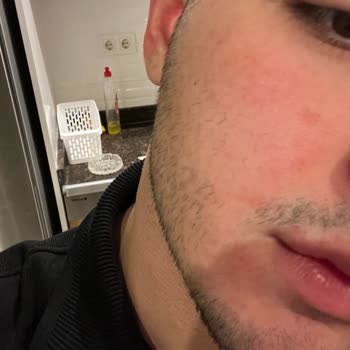 Cerave Limpiador Facial provoca irritaciones en la piel