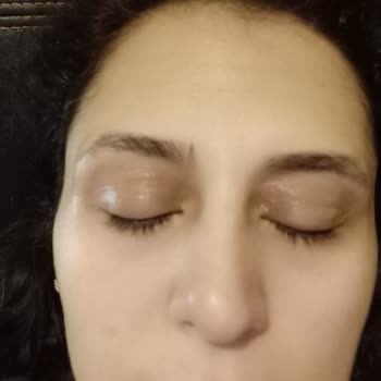 Ducray Dexyane crema de ojos causa hinchazón y enrojecimiento