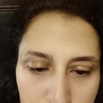 Ducray Dexyane crema de ojos causa hinchazón y enrojecimiento