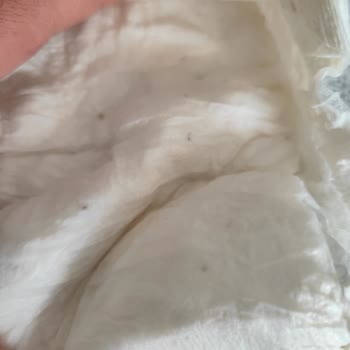 Sleepy Bebek Bezinde Sert Madde Şoku!