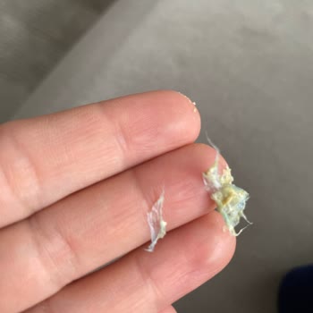 Ülker Ürününde Beklenmedik Yabancı Madde