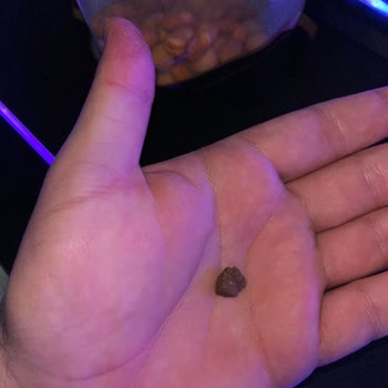 Sos Kaplı Taş: Dişim Kırılacaktı!