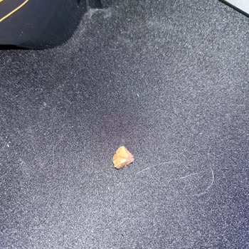 Sos Kaplı Taş: Dişim Kırılacaktı!