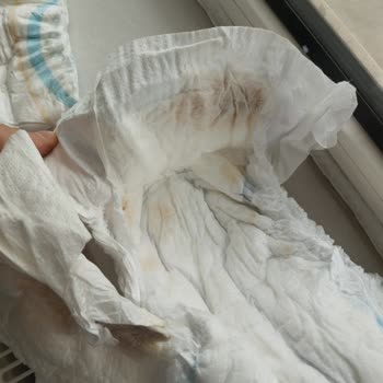 Molfix Bez Kalitesi Ve Fiyatı Hakkında Hayal Kırıklığı