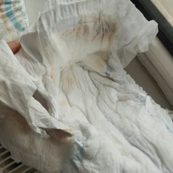 Molfix Bez Kalitesi Ve Fiyatı Hakkında Hayal Kırıklığı