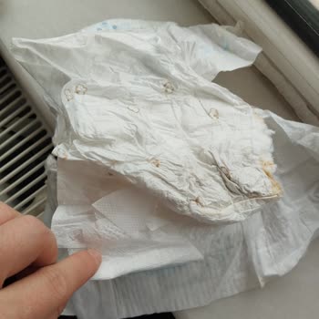 Molfix Bez Kalitesi Ve Fiyatı Hakkında Hayal Kırıklığı