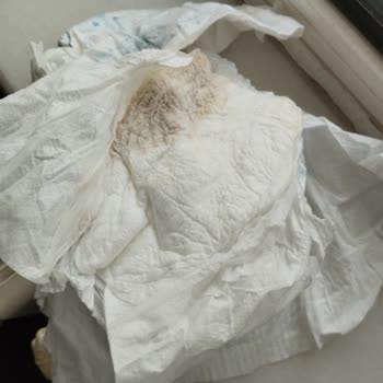 Molfix Bez Kalitesi Ve Fiyatı Hakkında Hayal Kırıklığı