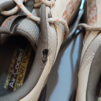 Skechers Ayakkabılarında Kısa Sürede Aşınma Ve Garanti Hayal Kırıklığı