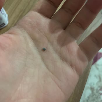 Eker Yoğurtta Taş Şoku: Hijyen Endişesi