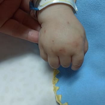 Bebeğime Yapılan Yanlış Tedavi Ve Hemşire Eksikliği