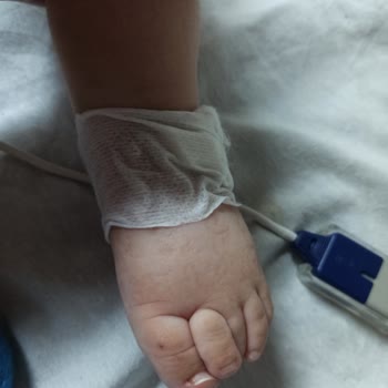 Bebeğime Yapılan Yanlış Tedavi Ve Hemşire Eksikliği