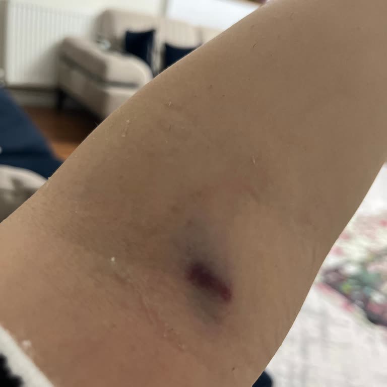 Acil Serviste Yetersiz Hizmet Ve Yanlış Müdahale