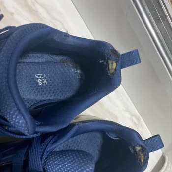 Skechers Ayakkabı Deformasyonu Ve A101 İletişim Sorunu