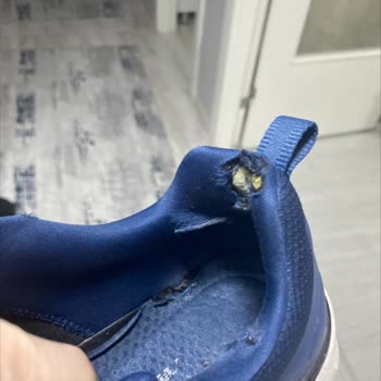 Skechers Ayakkabı Deformasyonu Ve A101 İletişim Sorunu