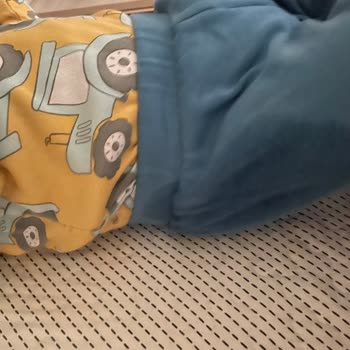 Kalitesiz Bebek Bezi: Sızıntı Sorunu Ve Mağduriyet