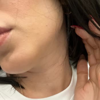 I Got Breakouts and Dull Skin from Chanel Skincare Despite the High Price Tag