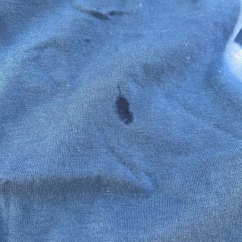 Miele Çamaşır Makinesi Lekeleri ve Servis Sorunları