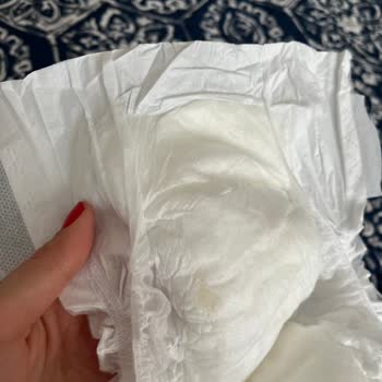 Sleepy Bebek Bezi: Sert Doku Ve Rahatsız Edici Yapışkan Sorunu