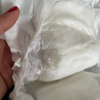 Sleepy Bebek Bezi: Sert Doku Ve Rahatsız Edici Yapışkan Sorunu