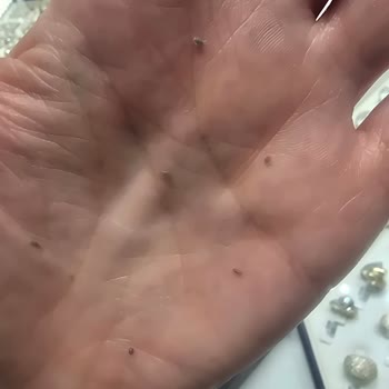 Kremde Anormal Soyulma Sorunu: Acil Çözüm Bekliyorum