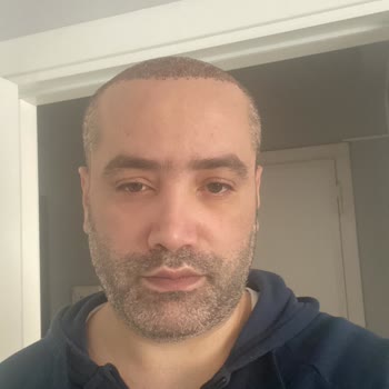 Saç Ekimi Sonrası Memnuniyetsizlik