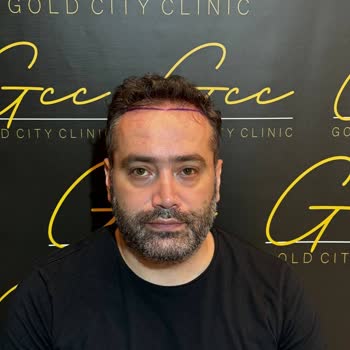 Saç Ekimi Sonrası Memnuniyetsizlik