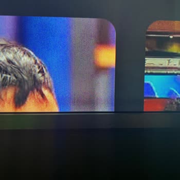 Philips Televizyonumun Garanti Kapsamında Çözülemeyen Sorunu