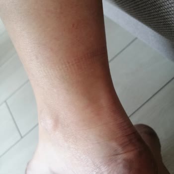 Hotiç Botların Kalitesizliği Ve Müşteri Güvenine Saygısızlık